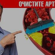Очистка Сосудов От Бляшек