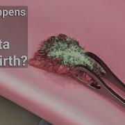 Placenta Born