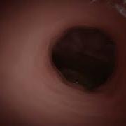 Pov Vore
