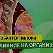 Ольга Шишова Хеликобактер