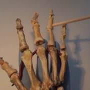 Кости Кисти