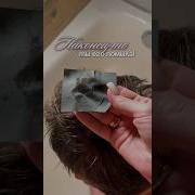 Dermsllehitmic