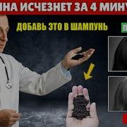 Волосы Укутали Сидину